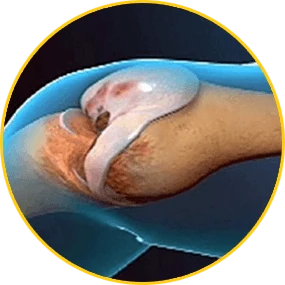 Artroflex Active: supporto alla rigenerazione della cartilagine.